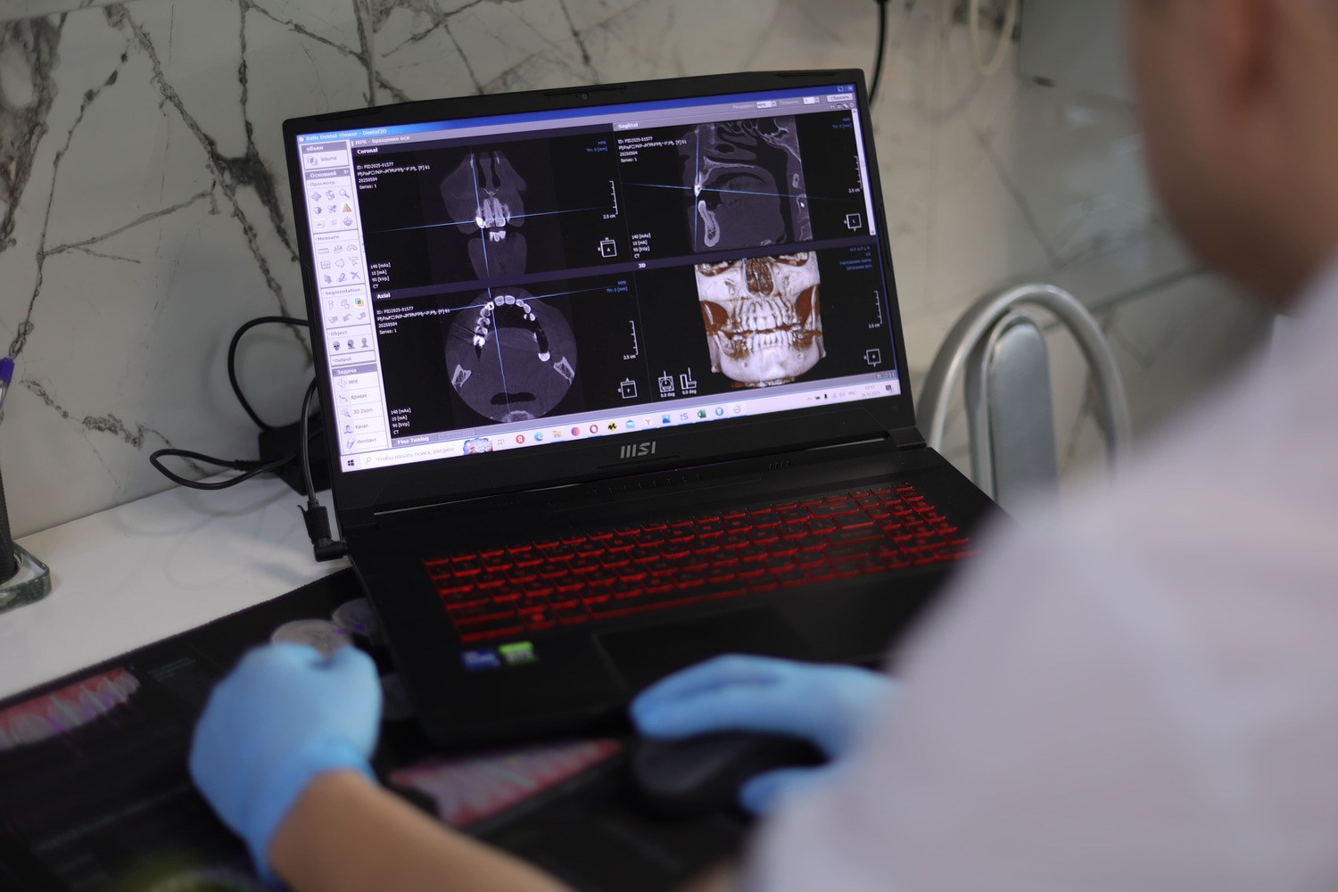 ИМПЛАНТАЦИЯ&nbsp;